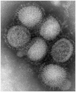 h1n1 virus